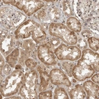 Immunohistochemical staining of human kidney shows moderate cytoplasmic positivity in cells in tubules.