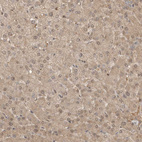 Anti-ASPSCR1 Antibody