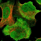 Immunofluorescent staining of human cell line U-2 OS shows localization to nucleoplasm & plasma membrane.