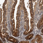 Immunohistochemical staining of human duodenum shows strong granular cytoplasmic positivity in glandular cells.