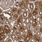 Immunohistochemical staining of human kidney shows strong granular cytoplasmic positivity in cells in tubules.