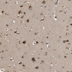 Immunohistochemical staining of human cerebral cortex shows strong granular cytoplasmic positivity in neuronal cells.