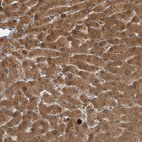 Immunohistochemical staining of human liver shows moderate to strong granular cytoplasmic positivity in hepatocytes.