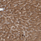 Anti-TRMT61B Antibody