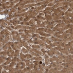 Immunohistochemical staining of human liver shows moderate to strong granular cytoplasmic positivity in hepatocytes.