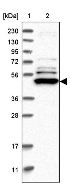 Lane 1: Marker [kDa] 230, 130, 95, 72, 56, 36, 28, 17, 11_br/_Lane 2: Human cell line RT-4