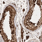 Immunohistochemical staining of human testis shows high expression.