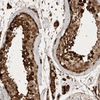 Immunohistochemical staining of human testis shows high expression.