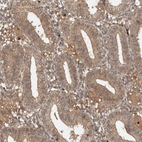 Immunohistochemical staining of human endometrium shows low expression as expected.
