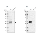 Western blot analysis using Anti-FAM221A antibody HPA026752 (A) shows similar pattern to independent antibody HPA026748 (B).