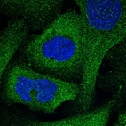 Immunofluorescent staining of human cell line U-2 OS shows localization to cytosol.