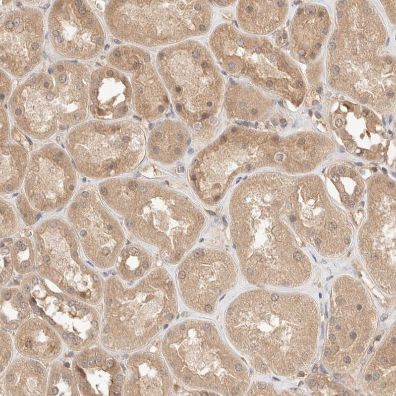 Anti-CARNMT1 Antibody