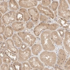 Anti-CARNMT1 Antibody