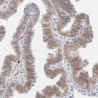 Immunohistochemical staining of human Fallopian tube shows moderate membranous positivity in glandular cells.