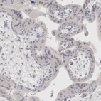 Immunohistochemical staining of human placenta shows no positivity in trophoblastic cells as expected.