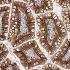 Immunohistochemical staining of human small intestine shows strong membranous positivity in glandular cells.