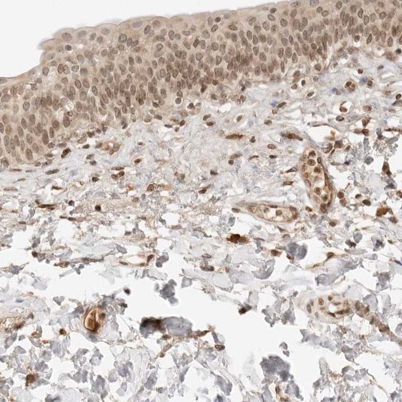 Anti-POLH Antibody