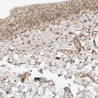 Anti-POLH Antibody