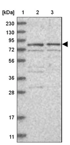 Lane 1: Marker [kDa] 230, 130, 95, 72, 56, 36, 28, 17, 11_br/_Lane 2: Human cell line RT-4_br/_Lane 3: Human cell line U-251MG sp