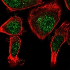 Immunofluorescent staining of human cell line PC-3 shows localization to nucleoplasm.