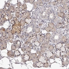 Immunohistochemical staining of human salivary gland shows weak cytoplasmic and moderate to strong membranous positivity in glandular cells.