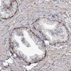 Immunohistochemical staining of human prostate shows moderate to strong cytoplasmic positivity in a subset of glandular cells.