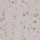Immunohistochemical staining of human cerebral cortex shows weak to moderate cytoplasmic positivity in neurons.