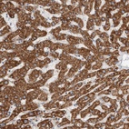 Anti-ECHDC2 Antibody