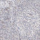 Anti-ECHDC2 Antibody