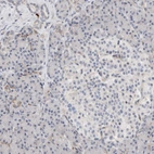 Immunohistochemical staining of human pancreas shows low expression as expected.