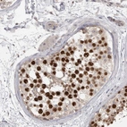 Immunohistochemical staining of human testis shows high expression.