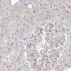 Immunohistochemical staining of human kidney shows low expression as expected.