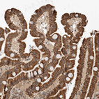 Immunohistochemical staining of human Duodenum shows strong granular cytoplasmic positivity in glandular cells.