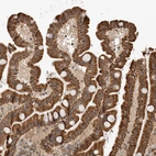 Immunohistochemical staining of human Duodenum shows strong granular cytoplasmic positivity in glandular cells.