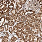 Immunohistochemical staining of human kidney shows strong granular cytoplasmic positivity in cells in tubules.