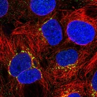 Immunofluorescent staining of human cell line CACO-2 shows localization to the Golgi apparatus.