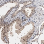 Immunohistochemical staining of human prostate shows moderate nuclear positivity in glandular cells.