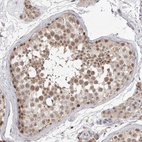 Immunohistochemical staining of human testis shows strong nuclear positivity in subset of cells in seminiferous ducts.