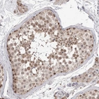 Immunohistochemical staining of human testis shows strong nuclear positivity in subset of cells in seminiferous ducts.