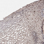 Immunohistochemical staining of human cervix, uterine moderate nuclear positivity in squamous epithelial cells.