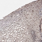 Immunohistochemical staining of human cervix, uterine moderate nuclear positivity in squamous epithelial cells.