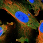 Immunofluorescent staining of human cell line U-251 MG shows localization to nucleoplasm, cytosol & mitochondria.