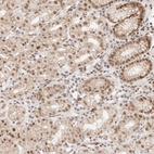 Anti-HOXC5 Antibody