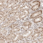 Anti-HOXC5 Antibody