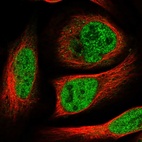 Immunofluorescent staining of human cell line U-2 OS shows localization to nucleoplasm.