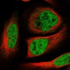 Immunofluorescent staining of human cell line U-2 OS shows localization to nucleoplasm.