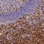 Immunohistochemical staining of human lymph node shows high expression.