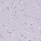 Immunohistochemical staining of human cerebral cortex shows low expression as expected.