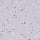 Immunohistochemical staining of human cerebral cortex shows low expression as expected.
