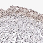 Anti-RNF2 Antibody